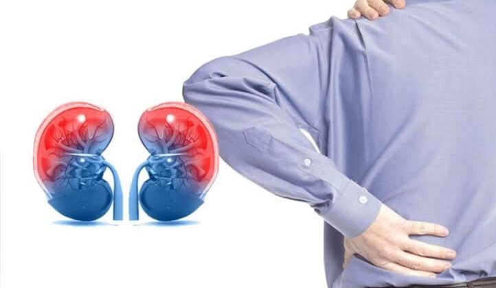 Böbreklerdeki gizli tehlike bu testle ortaya çıkıyor
