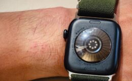 Apple Watch kullanıcıları “cilt tahrişi” şikayetiyle ürünü iade ediyor